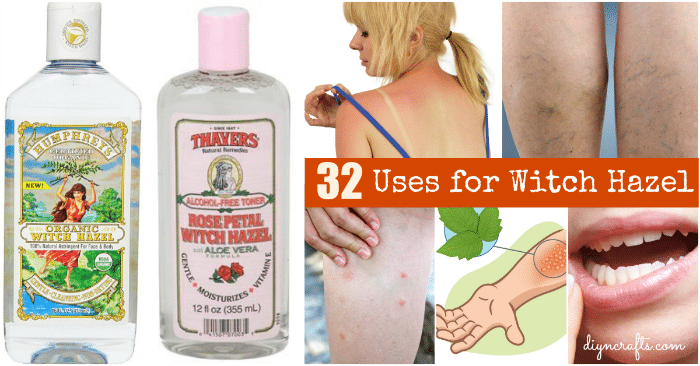 32 Unbelievable Uses for Witch Hazel: Beauty, Health, Pet Care and Home